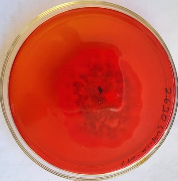 41. Basidiobolus Spp. Back Side
